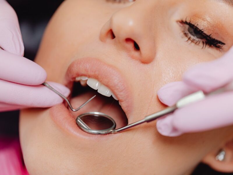 Dental Exam