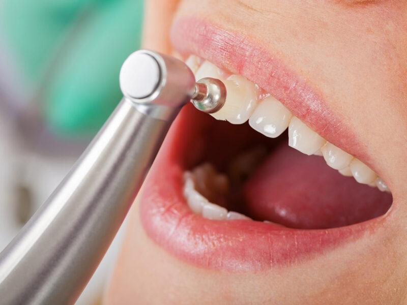 oral hygienist in liverpool
