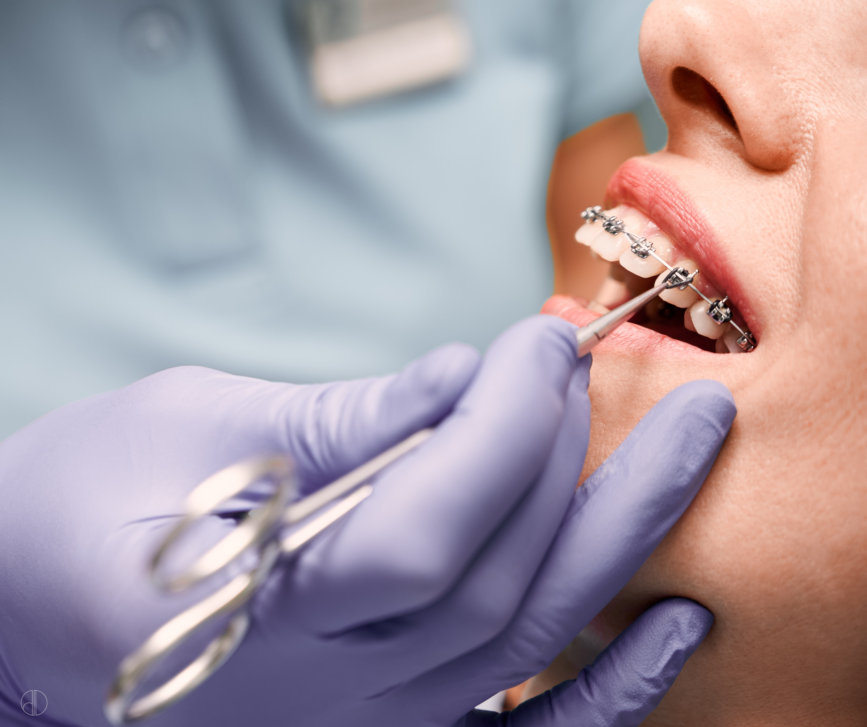 braces in liverpool