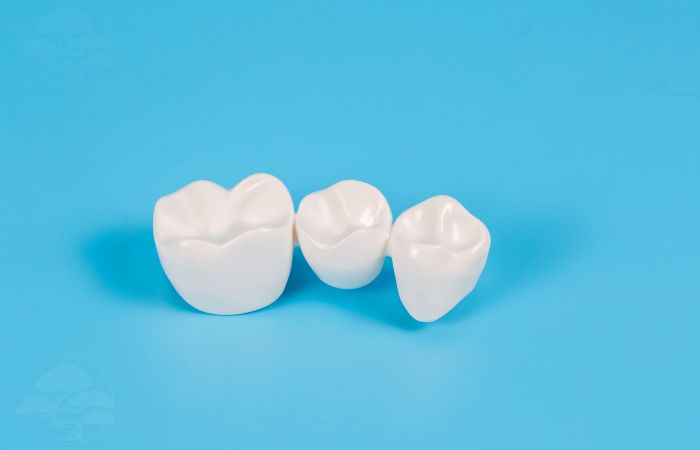 Dental Bridge