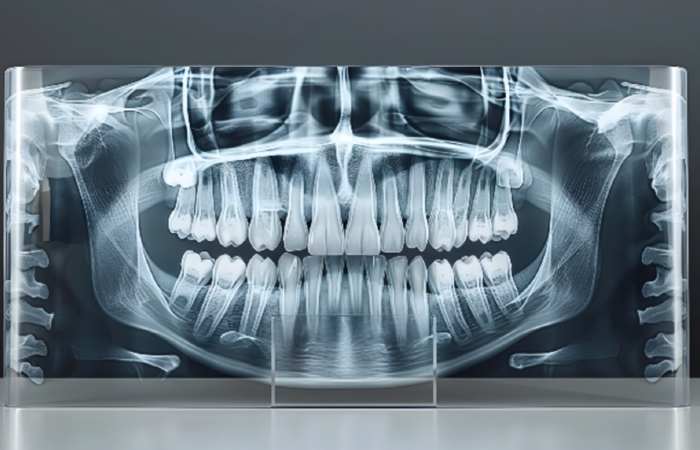 Weakened Bone & Tissue
