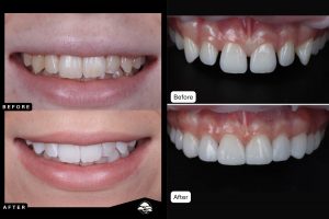 fix my smile in liverpool