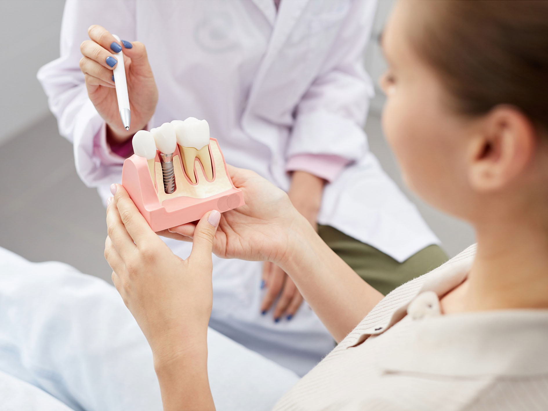 all-on-4 dental implants in liverpool