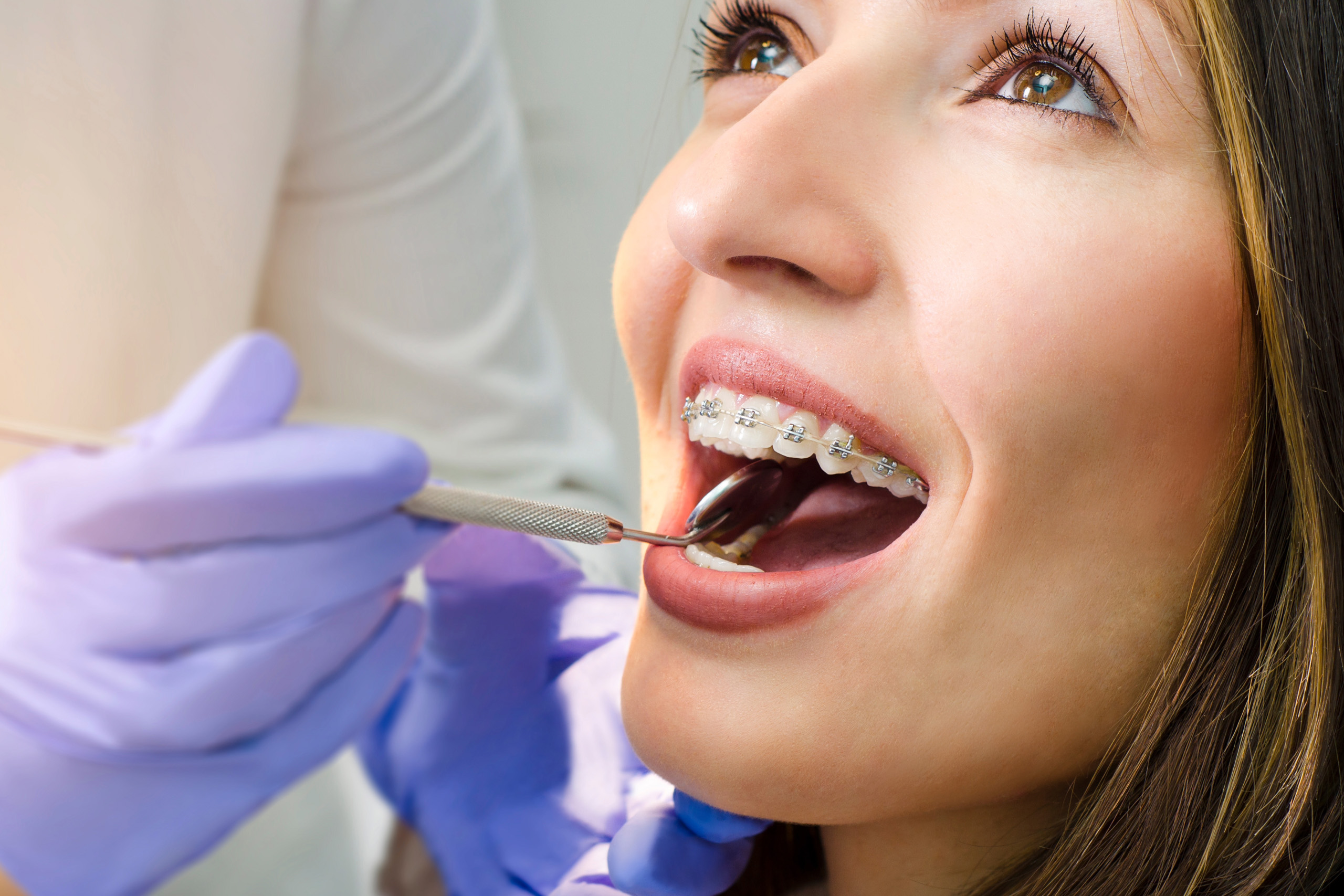 fixed braces in liverpool