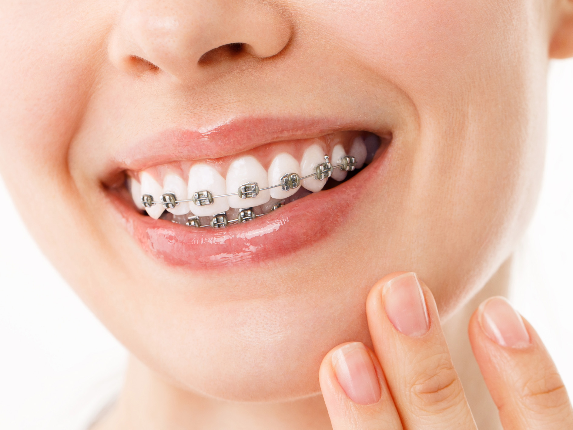 adult braces in liverpool