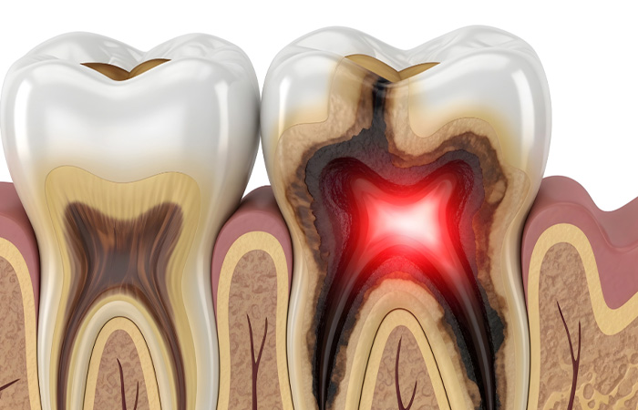 dental infection in liverpool