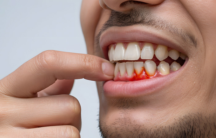 swollen gums in liverpool